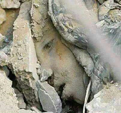 عکس: کودکی که زیر بمباران سعودیها دفن شد