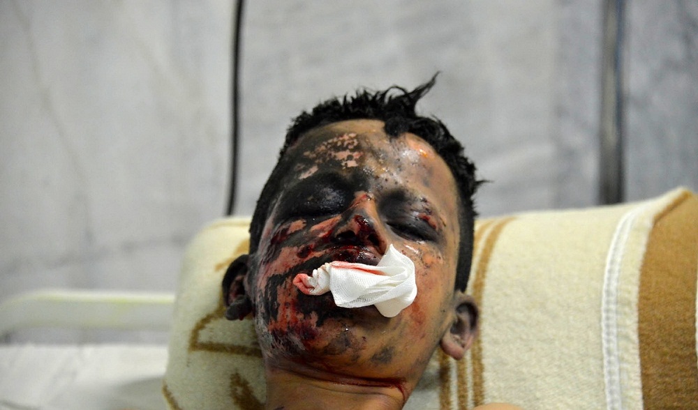 تصاویر : مصدومان چهارشنبه سوری در سال گذشته