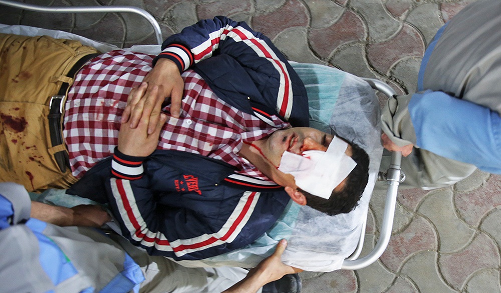 تصاویر : آسیب دیدگان حوادث چهارشنبه سوری