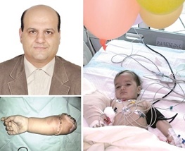 برای نخستین بار در دنیا در شیراز اتفاق افتاد؛ پیوند دست قطع‌شده کودک ۱۳ماهه