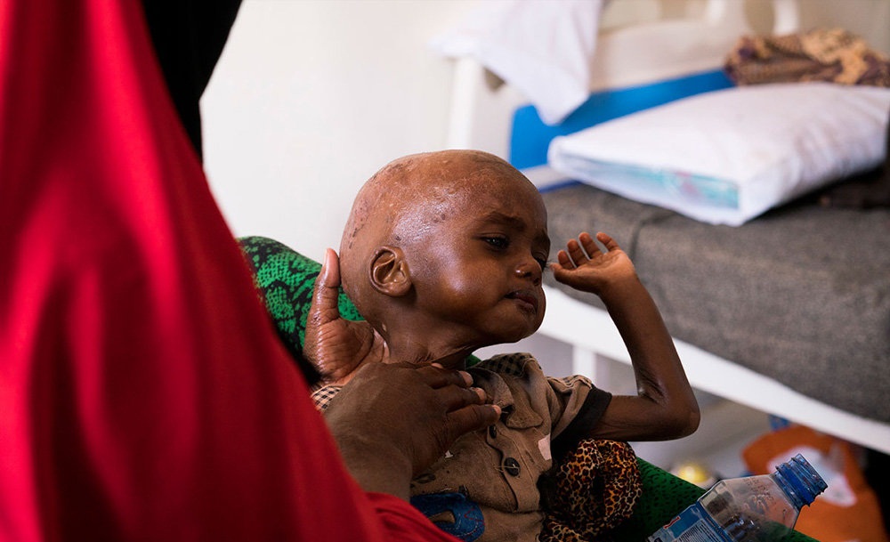 تصاویر : مقابله با گرسنگی در سومالی‎