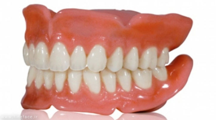 ٧ نکته مهم در استفاده از دندان مصنوعی