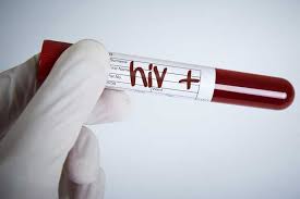 مورد مثبتی از آزمایش اچ.ای.وی در گرم خانه‌های همدان ثبت نشد