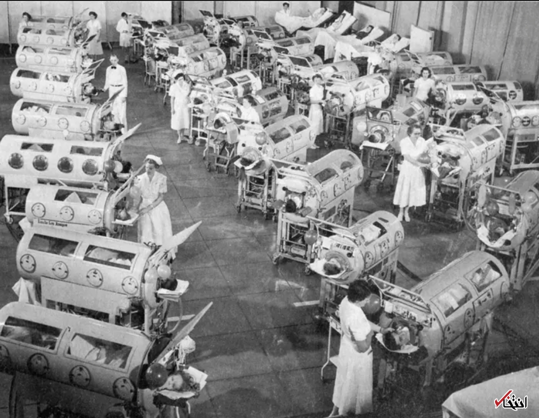 تجربه عجیب ۶۸ سال زندگی با ریه آهنی+تصاویر تجربه عجیب ۶۸ سال زندگی با ریه آهنی+تصاویر