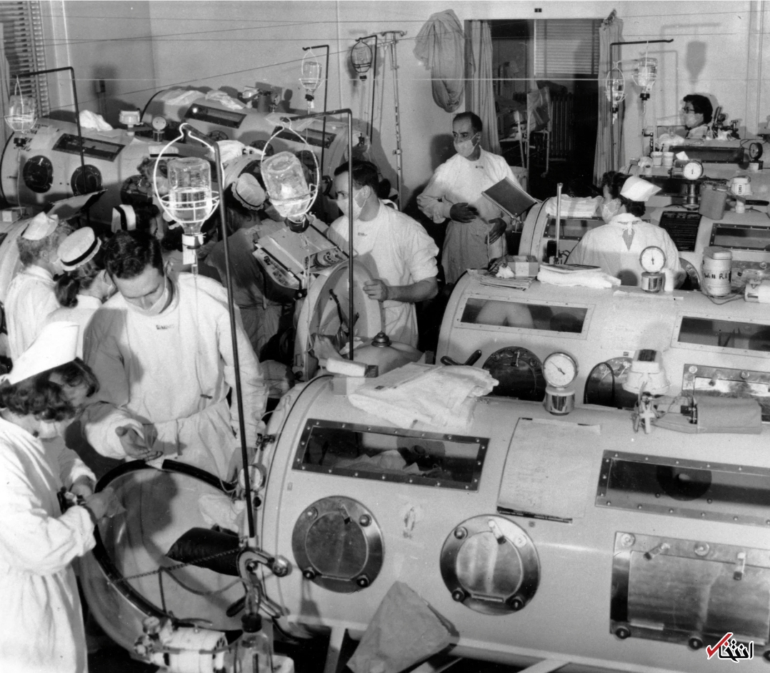 تجربه عجیب ۶۸ سال زندگی با ریه آهنی+تصاویر تجربه عجیب ۶۸ سال زندگی با ریه آهنی+تصاویر