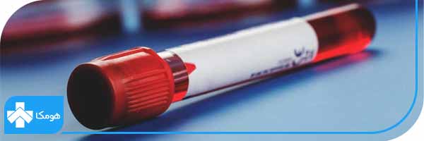 آیا حملات قلبی با آزمایش CRP تشخیص داده میشوند؟ در آزمایش خون چیست