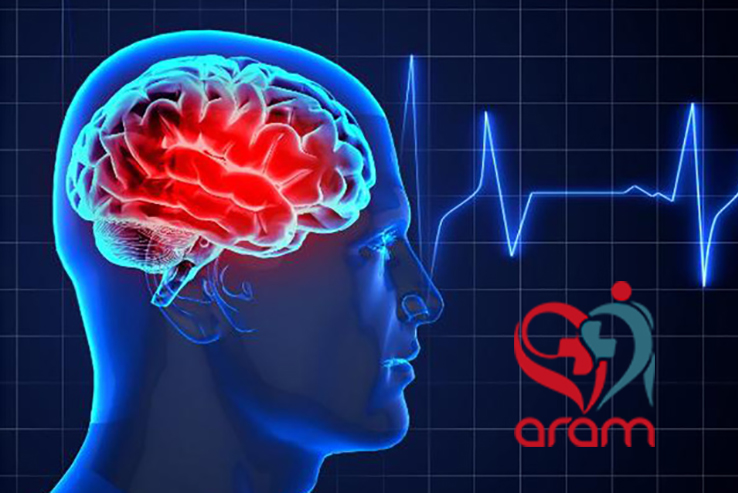 چگونه بهترین متخصص مغز و اعصاب را انتخاب کنیم؟ چگونه بهترین متخصص مغز و اعصاب را انتخاب کنیم؟