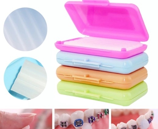 آیا با اصطلاحات ارتودنسی دندان آشنا هستید؟ آیا با اصطلاحات ارتودنسی دندان آشنا هستید؟